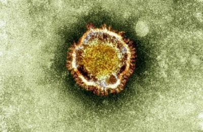 What are the Coronavirus Symptoms